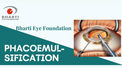 Best-Phacoemulsification-Surgery-in-Delhi-Bharti-Eye-Foundation