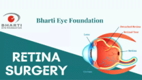Best Retina Surgery in Delhi | Bharti Eye Foundation
