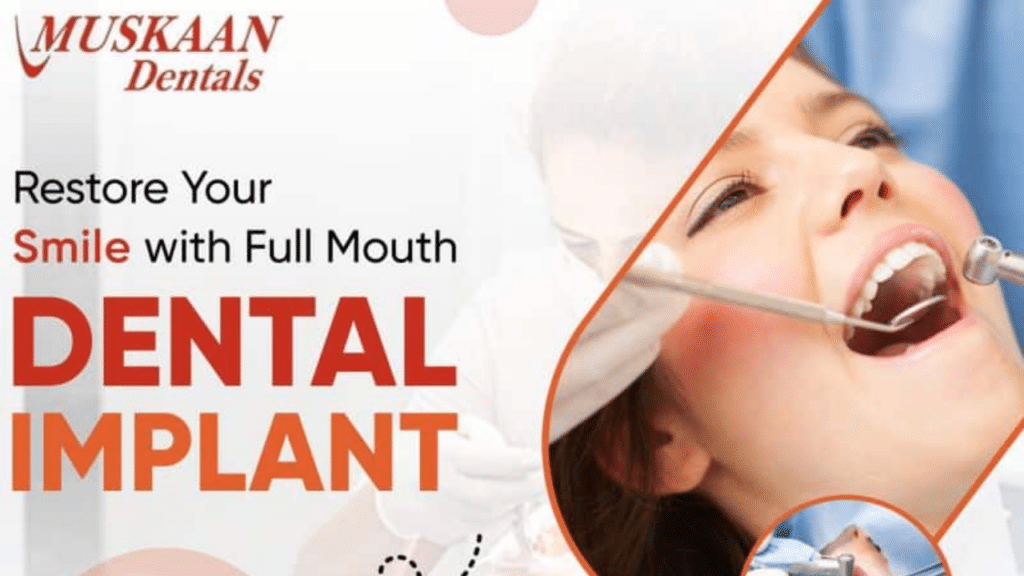 Dental Implant in Gurgaon Muskaan Dentals Global