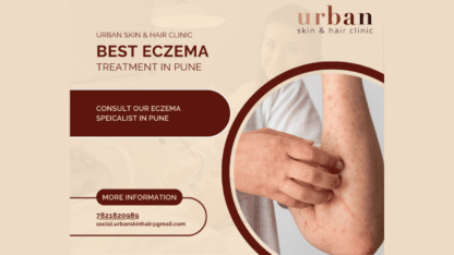 Effective-Eczema-Treatment-in-Pune-Urban-Skin-and-Hair-Clinic