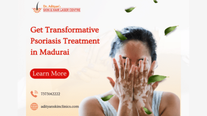 Psoriasis-Treatment-in-Madurai-Adityan-Skin-and-Hair-Laser-Centre