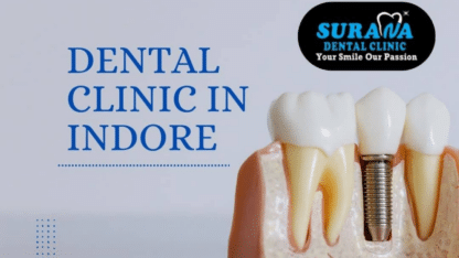 Trusted-Dental-Clinic-Near-Me-Surana-Dental-Clinic