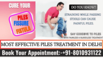 Which is The Best Doctor For Piles Treatment in Delhi?