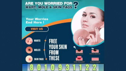 Who-is-The-Best-Doctor-For-Skin-Treatment-in-Delhi