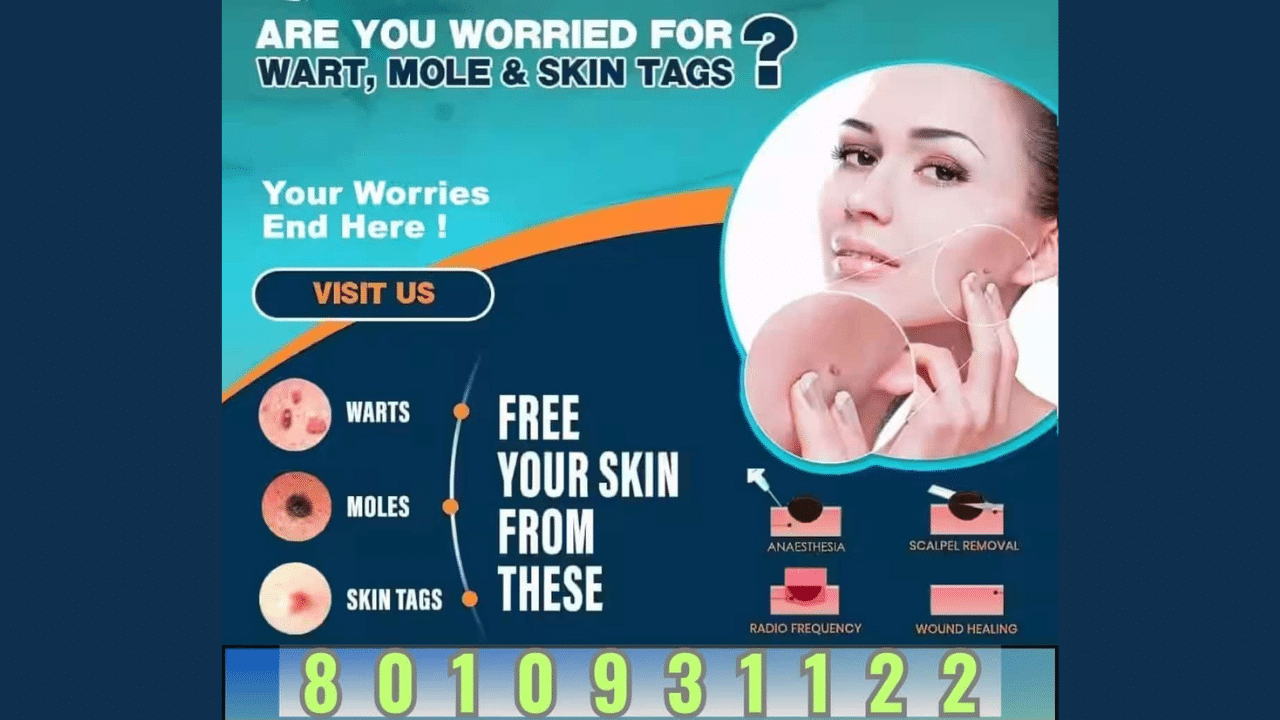 Who is The Best Doctor For Skin Treatment in Delhi?