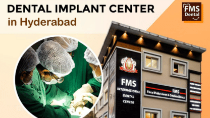 Best-Dental-Clinic-in-Jubilee-Hills-Hyderabad