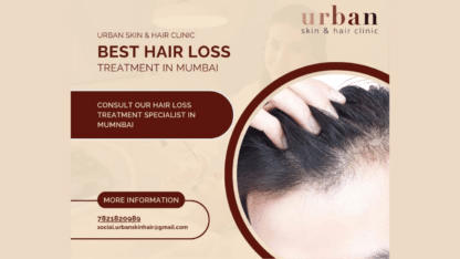 Best-Hair-Loss-Treatment-in-Mumbai