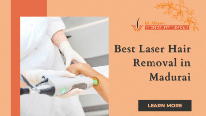 Best-Laser-Hair-Removal-in-Madurai-1