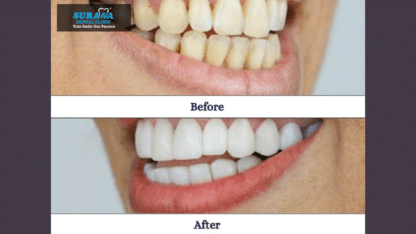 Dental-Clinic-Indore-Surana-Dental-Clinic