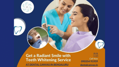 Teeth-Whitening-Service-in-Bengaluru