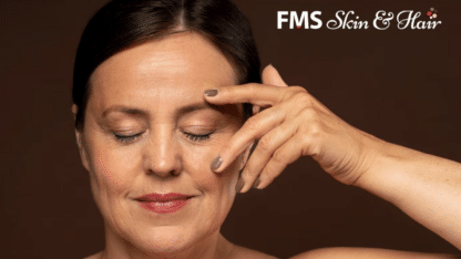 Vampire-Facial-Treatment-in-Hyderabad-FMS-Skin-and-Hair-Clinic
