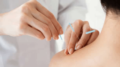 Acupuncture-Treatment-in-Central-London-David-Canevaro