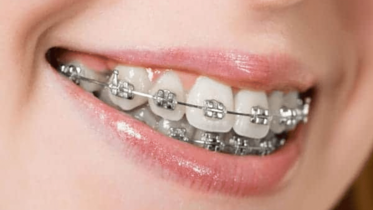 Smile Brighter Live Better – Dental Implants in Chandigarh | Dr. Sharma’s Dental Hub