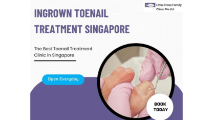 Get-Relief-Ingrown-Toenail-Treatment-at-Little-Cross-Family-Clinic