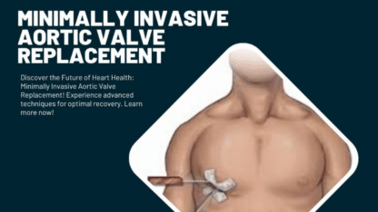 Minimally-Invasive-Aortic-Valve-Replacement-Micsheart