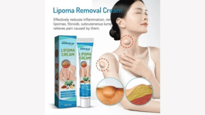 South-Moon-Lipoma-Removal-Cream-Well-Mart
