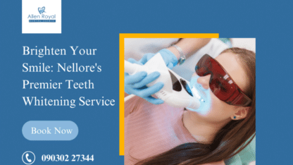 Teeth-whitening-service-1.png-1