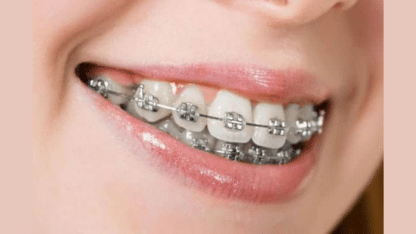Top-10-Orthodontists-in-Chandigarh