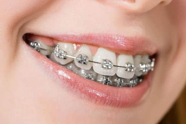 Smile Brighter Live Better - Dental Implants in Chandigarh | Dr. Sharma’s Dental Hub