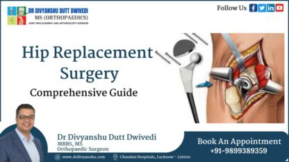 hip-replacement-surgery-dr-divyanshu-
