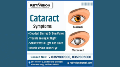 Best-Cataract-Surgery-Treatment-in-Raipur-Retivision-Superspeciality-Eye-Centre