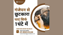 Best Hair Wig Shop in Delhi – Get Rid of Baldness in Just 1 Hour