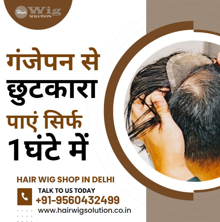 Best Hair Wig Shop in Delhi - Get Rid of Baldness in Just 1 Hour