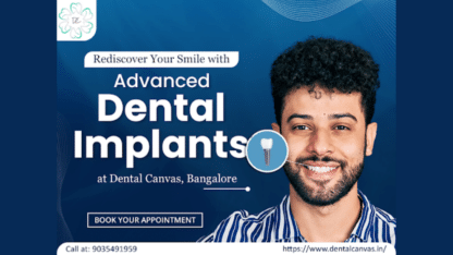 Dental-Implants-in-Bangalore-Affordable-Implant-Solutions-Dental-Canvas®