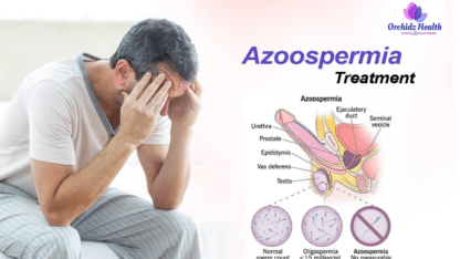 Effective-Azoospermia-Treatment-in-Bangalore-Orchidz-Health