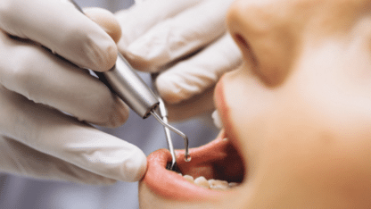 Ekdantam-Clinic-Bringing-In-House-Dental-Lab