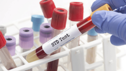 Fast-and-Accurate-Results-STD-Screening-at-Little-Cross-Family-Clinic