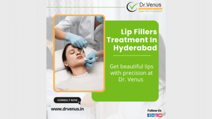 Lip-Fillers-Treatment-in-Hyderabad-Dr.-Venus
