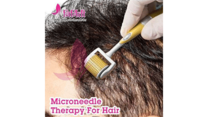Microneedle-Therapy-For-Hair