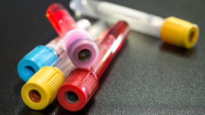 Best-EDTA-Tubes-From-Ahmedabad