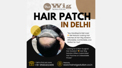 Affordable-Hair-Patch-in-Delhi-Hair-Wig-Solution