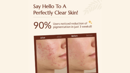 Gluta-Hyaluronic-Luxury-Soap-Enriched-with-Glutathione-Kojic-Acid-Betaine-Hyaluronic-Acid