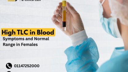 High-TLC-in-Blood-Symptoms-and-Normal-Range-in-Females