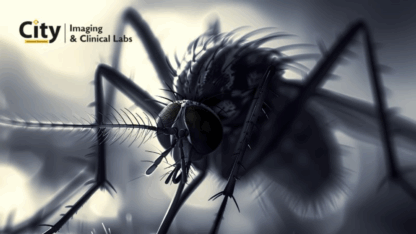 Malaria-Symptoms-and-Blood-Test-Name-You-Should-Know