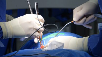Minimally-invasive-surgery
