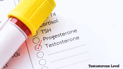 Testosterone-Level-Test