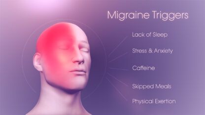 Medical-Animation-showing-Migraine-Triggers