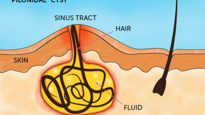 3425beed-9768-4416-9175-1558422dc5ec-3