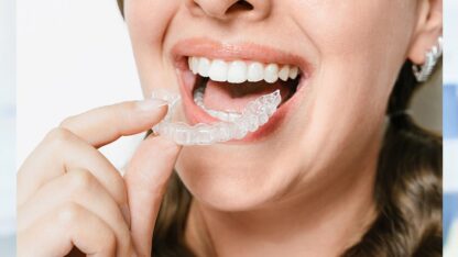 Best-Aligners-in-Sainikpuri-1