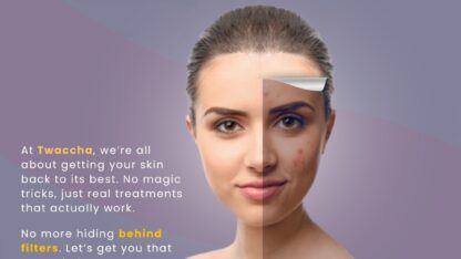 Dark-Spot-Remover-for-Face-Hyderabad