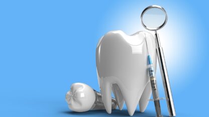 Dental-Treatment-in-Kukatpally