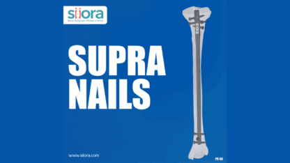 Supra-Nails-–-Reliable-Orthopedic-Implants-by-Siora-Surgicals-Pvt.-Ltd