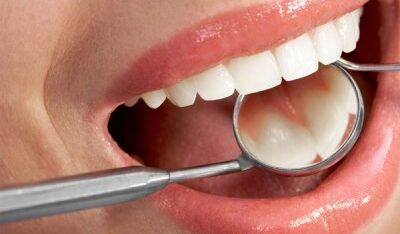 cosmetic-dentist-olathe