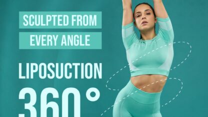liposuctuion-benifits