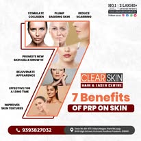Best Acne Scar Laser Treatment in India