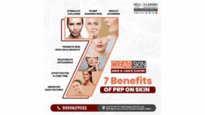 Best-Acne-Scar-Laser-Treatment-in-India